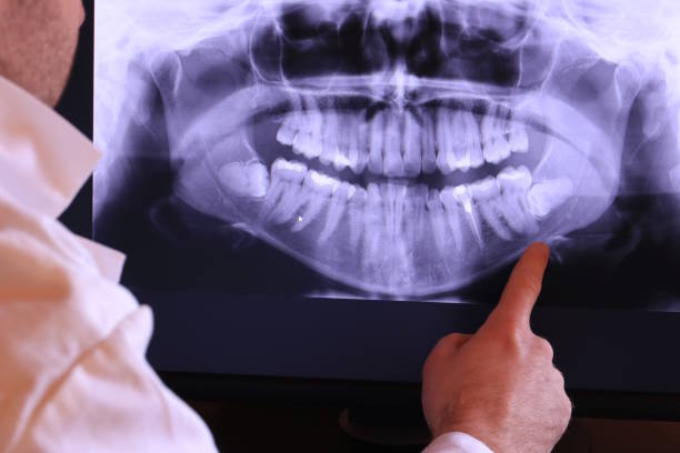 Best Emergency Gum Treatment in Naples Manor, FL