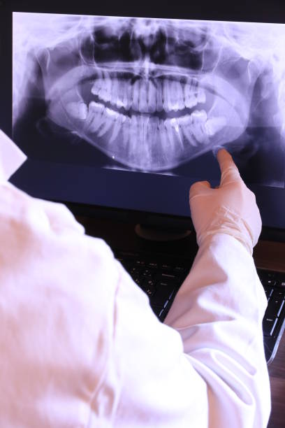 Best Emergency Wisdom Teeth Removal in Naples Manor, FL