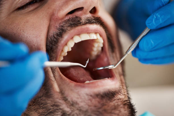 Best Weekend Emergency Dentist in Naples Manor, FL